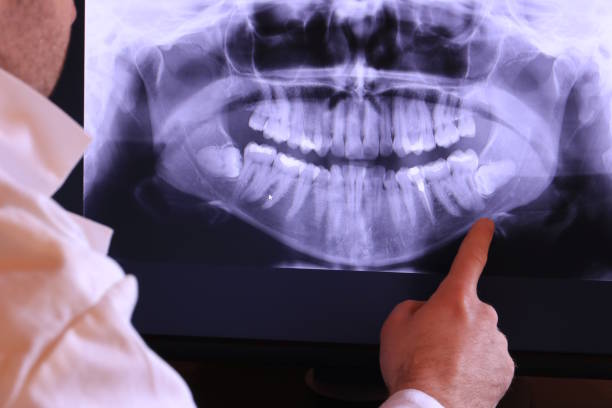 Best Chipped Tooth Repair Near Me  in Ligh, NE